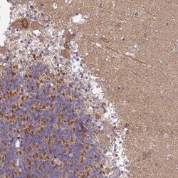 Gigaxonin Antibody, Novus Biologicals:Antibodies:Primary Antibodies